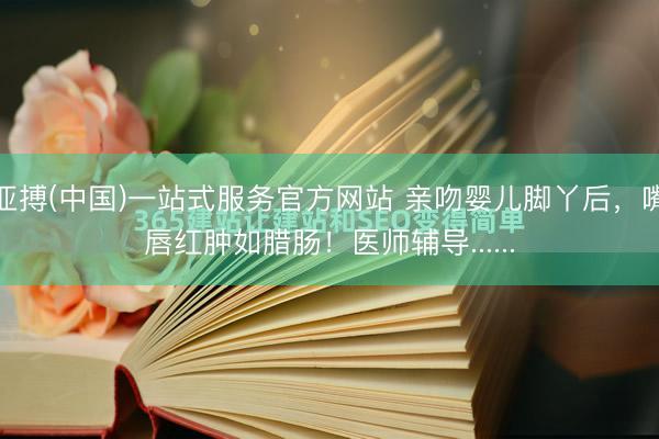 亚搏(中国)一站式服务官方网站 亲吻婴儿脚丫后,嘴唇红肿如腊肠!医师辅导......